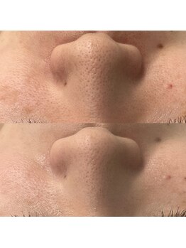 ヴェルシック(Belchic)/毛穴を引き締めて化粧ノリも良く