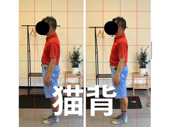 カワル整体 長嶺院/猫背
