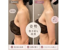 ルルアス(LuLuAS)の雰囲気（首こりや肩こり・猫背・巻き肩解消してスッキリ軽く）