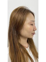 ナノハナ/鹿沼市の全身脱毛美容室ナノハナ