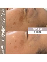 ビューティリュクス(beauty luxe)/肌育！50歳になっても輝く肌へ。
