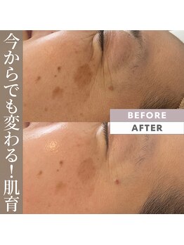 ビューティリュクス(beauty luxe)/肌育！50歳になっても輝く肌へ。