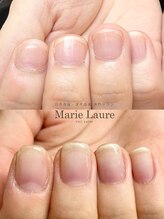 マリーロール 梅田店(Marie Laure)/自爪育成/深爪矯正/ネイルケア