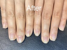 アンドネイル 海老名(&nail)/深爪緩和★After