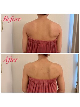 ユーブルーム(youbloom)/美ボディーライン★背中の変化★