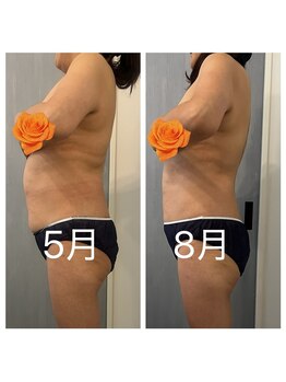 美温(mion)/脂肪燃焼