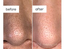 ウェヌ(VENE)の雰囲気（【マツヤニWAX】繰り返すお悩みからサヨナラしちゃいましょう♪）