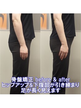 ワイルドボディ(WILD BODY)/骨盤矯正