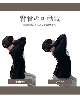 まこと整体院 新鳥栖店/背骨の可動域