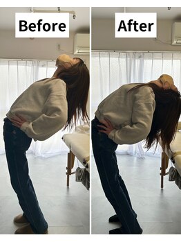 Root整体院【首・肩こり/腰痛/根本改善】/腰痛Before/After