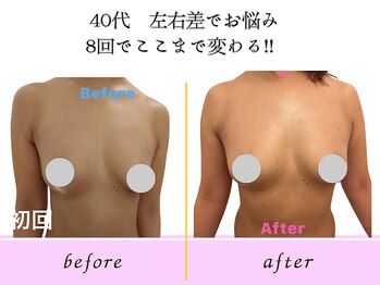 ビーハピネス 京都西院(B-Happiness)/40代バストアップキープ