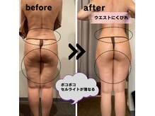 強力痩身専門店　西麻布【La.SALON HOPE】の雰囲気（凸凹セルライトが滑らかなラインへ）