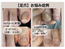 エム 平岸(M)の雰囲気（【足爪】巻き爪・肥厚爪・変形爪・厚みのある爪・甘皮ケアもOK！）