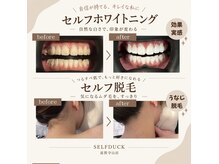 セルフダック 滋賀守山店(SELFDUCK)