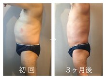 伊達男/フォースカッター 事例