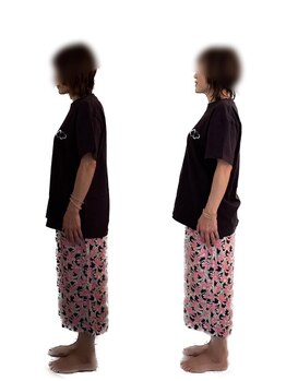 ジュゲム(JUGEM)/Before After