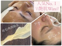 リノ(Lino)の雰囲気（産毛・角質・顔ダニ・くすみ・ざらつき！圧倒的なリピート率）