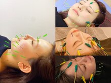 本数の調節やご希望などなんでもご相談ください！