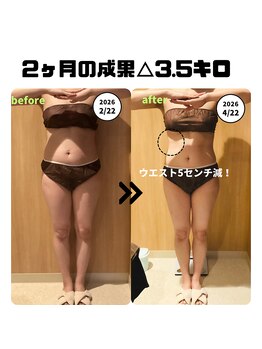 ミルキー(MiLuKy)の写真/早く始めなきゃ◎MiLuKyでダイエットスイッチ入れましょう！