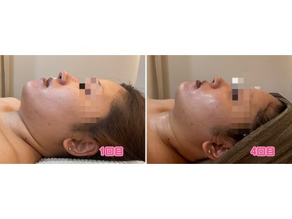 ミラ(Mira)の写真
