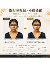 エモシオン トウキョウ(EMOTION TOKYO)/造形美容鍼×小顔矯正