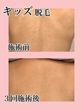 メゾン ミニョンヌ(maison mignonne)/ビフォーアフター