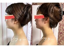 アコラージュ/レモンボトル/小顔/ブライダル