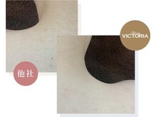 サロン ニヒル(SALON NIHIL)/◇背中脱毛◇