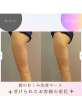 アルコイリス(arcoiris)/脚のむくみ改善　引き締め　