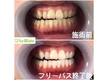 ルブラン 奈良店(Le Blanc)/新年度直前！