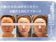 モルティー 広島店(Molti)の雰囲気（フェイシャル・お背中にも◎肌質改善・たるみ・シワ改善生BTX）