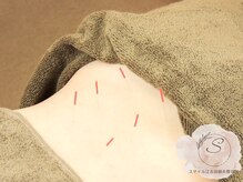 スマイル江古田鍼灸整体院の雰囲気（国家資格所得者による本格整体、鍼灸施術になります）