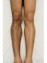 リアン(Rian)/メンズ/あし脱毛／ワックス