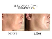 トニートニー(Tony Tony)