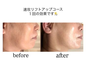 トニートニー(Tony Tony)