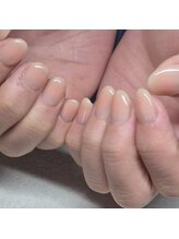 アモ ネイル(amo nail)/チークネイル