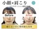 ウニカ(Unica)の写真