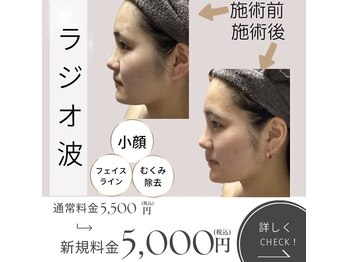 きれい塾 恵比寿/ラジオ波