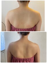 ブリランテ(Brillante)/体験→継続3回目beforeafter