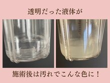 フェスティナ レンテ(Festina Lente)