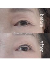 ネマウム(nemaum)/