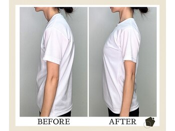 サンク(Cinq)/ストレートネック/猫背を改善