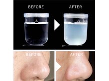 毛穴の皮脂や角質を吸引＆洗浄！ざらつきや黒ずみを改善☆