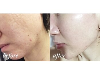 スリリアン 銀座/★お客さまビフォーアフター★