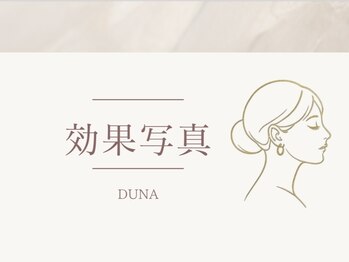 ドゥナ(DUNA)/効果写真