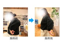 さくらの整体院/こんなに肩と腕が回るように