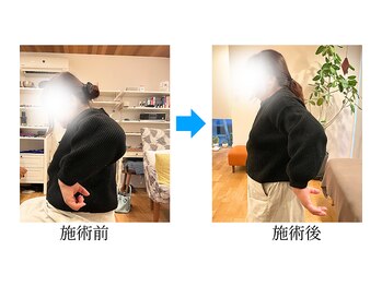 さくらの整体院/50代女性・肩の痛みでおなやみ