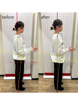 ほねつぎ 高津はりきゅう接骨院/骨盤l矯正★腰痛・足のむくみ