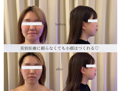 アルテ 神戸(Arte)の写真