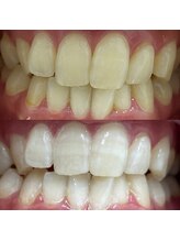 イイハキューブ(e8 cube)/before & after